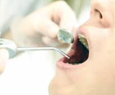 歯科医院にかかっている方、ご質問うけます イメージ1