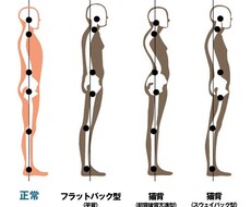体の重心バランスのズレを鼻緒テーピング法ます イメージ1