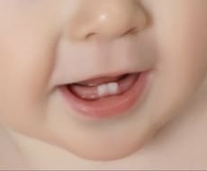 子どものお口のお悩み解決致します 小児歯科衛生士10年のベテランが相談のります！