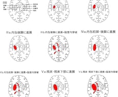 医療者向けの資料用イラストを作成致します イメージ1