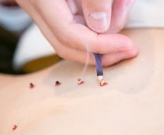 国家資格保有の鍼灸師があなたに必要なツボを教えます イメージ1