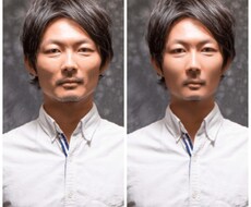 写真で整形体験をして頂けます イメージ1