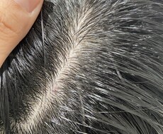 お金と時間をかけず白髪を無くす方法お伝えします イメージ1