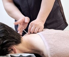鍼灸の学生から新卒の方のご相談に乗ります イメージ1