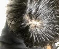 血流改善で頭頂部の薄毛を改善させます 内服薬などの副作用が不安な方必見！