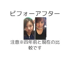女性専門！美容整形をお考えの方私が相談に乗ります イメージ1