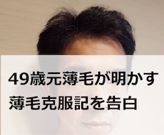 49歳薄毛ハゲを克服した経緯を詳らかにお教えします アラフィフでも大丈夫！私が薄毛ハゲを克服した経緯を全て公開