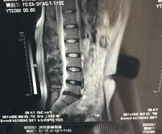 ヘルニアなど、脊椎の病気、自身で治せます イメージ1