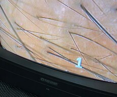 気になる前髪のケア教えます イメージ1