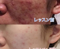最近の美肌術を教えます イメージ1