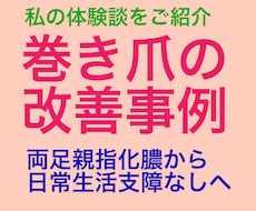 巻き爪でお困りの方へ、わたしの対処法を紹介します 以前は両足の親指が化膿していましたが今は好転しかなり歩けます