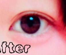 一重から二重まぶたになる方法教えます 一重まぶたで悩んでいる人、アイプチでごまかしている人必見！