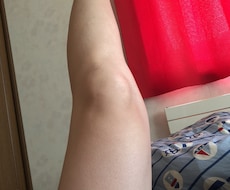 永久脱毛は自宅で出来ます イメージ1