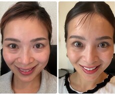 表情筋講師があなたのお顔をデザインします イメージ1