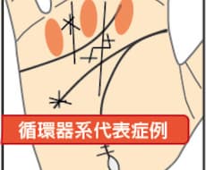 掌紋医学の手相診断で身体の弱い所をお伝えします 将来的疾患リスク、健康運を専門的な手相鑑定で簡単チェック