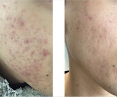 お悩みの肌トラブルを解決いたします イメージ1