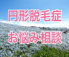 円形脱毛症のお悩み相談⭐︎四柱推命鑑定もします