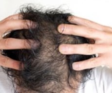 天然のアレを使うだけで育毛効果があります 薄毛やまつ毛にハリが無い方必見です！