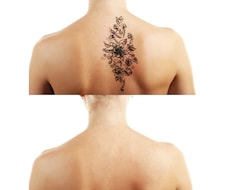 【画像修正・ レタッチ】Tattoo(刺青)・アザ・手術痕などを消去♪ イメージ1