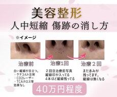 人中短縮の傷跡で悩んでる方❗️アドバイスします イメージ1