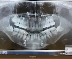 チャットで！美容整形お見せします＆ご相談に乗ります イメージ1