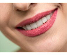 お口のお悩み、ホワイトニングの相談のります イメージ1