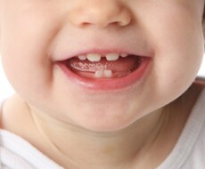 お子様のお口に関する悩みについてご相談にのります イメージ1
