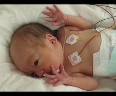 NICU退院後の発達相談、経験からお話します イメージ1