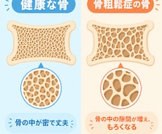 骨粗鬆症マネージャーが骨密度・健康相談にのります イメージ1