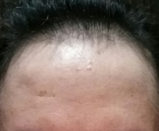 薄毛の悩み少しでも改善できるよう相談のります 薄毛に悩んでうつむき加減になっているあなたへ