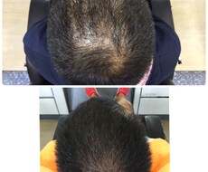 身体の悩みから抜け毛の原因解明します イメージ1