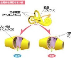 めまいで悩んでいる方改善方法教えます イメージ1