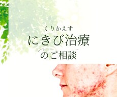 繰り返すにきびの治療スキンケア相談のります イメージ1