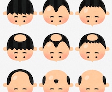 ハゲ•薄毛に効くおすすめの方法を教えます イメージ1