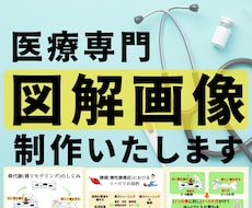 医療の専門性を優しく伝える図解画像を制作します イメージ1