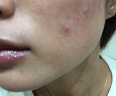 お肌のお悩み、コンプレックスお聞きします イメージ1