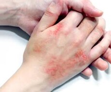 肌荒れの相談のります イメージ1