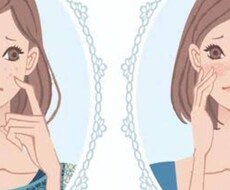 シミSR治療についてお答えします イメージ1