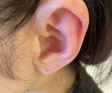 耳ツボ　体の不調な部分のツボお教えします イメージ1