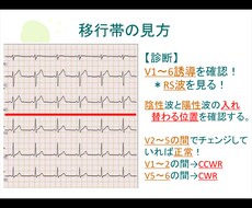 心電図の基礎を伝授します イメージ1