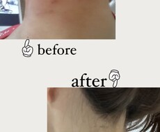 アトピーのお悩み聞きます イメージ1
