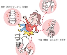 骨粗鬆症の治療薬について教えます イメージ1