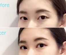 二重になる方法伝授します イメージ1