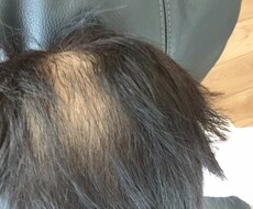 男性お悩みのAGAを経験を元に格安でお伝えします イメージ1