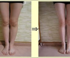 すぐに足が細くなるダイエットをお伝えます 太ももとお尻に悩んでいる人にオススメ