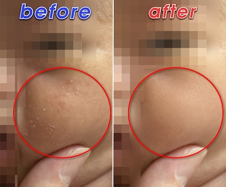 動画制作・動画編集・動画補正に丁寧・高品質に応ます 動画レタッチ|ぼかし|モザイク|テロップ|学術論文|動画広告 イメージ2