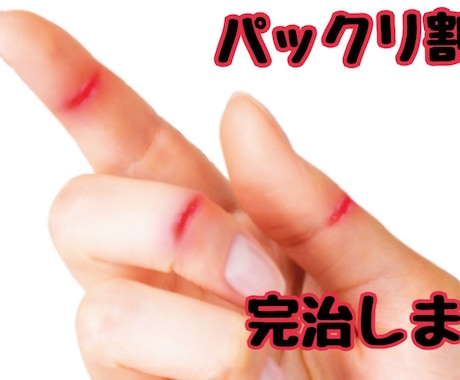 パックリ、ヒビ割れの治す方法をお教えします ひび、パックリ割れ痛いですよね。しっかり根完治しましょう。 イメージ1