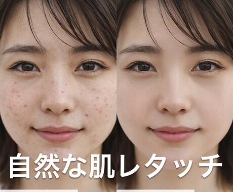 自然な肌レタッチ・ニキビや肌荒れを修正ます 満足いただけるまで無料で対応いたします イメージ2