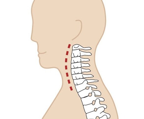 整骨院の先生が教える身体の知識や改善策教えます 歪み、トレーニング、栄養、怪我や腰痛などに悩む方にオススメ イメージ1