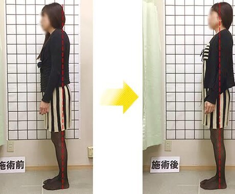 60代からの猫背姿勢改善手伝います 免疫改善、ご家族の姿勢が不安な方へ イメージ2